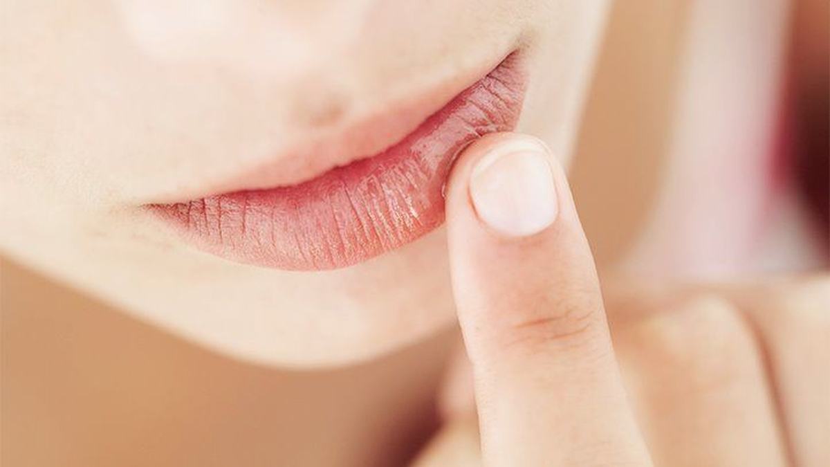 dudak kuruluğu neden olur dudak kuruması nasıl geçer